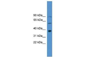 WB Suggested Anti-PITX1 Antibody Titration:  0. (PITX1 抗体  (Middle Region))