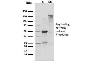 SDS-PAGE Analysis Purified IL-10R1 Rat Monoclonal Antibody (1B1. (IL-10RA 抗体)