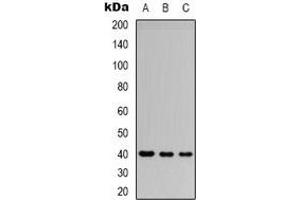 Western blot analysis of CD32b expression in Jurkat (A), SHSY5Y (B), HEK293T (C) whole cell lysates. (FCGR2B 抗体  (C-Term))
