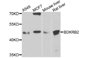 Western blot analysis of extracts of various cell lines, using BDKRB2 antibody. (BDKRB2 抗体  (AA 302-391))