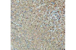 IHC analysis of ABI2 using anti-ABI2 antibody (ABIN7600125). (ABI2 抗体  (AA 151-400))