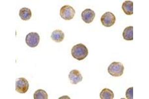 Immunocytochemistry of DFF45 in HeLa cells with AP30289PU-N DFF45 antibody at 5 μg/ml. (DFFA 抗体  (C-Term))