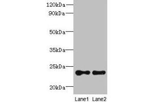 Western blot All lanes: TMED2 antibody at 6 μg/mL Lane 1: HCT116 whole cell lysate Lane 2: Mouse ovarian tissue Secondary Goat polyclonal to rabbit IgG at 1/10000 dilution Predicted band size: 23 kDa Observed band size: 23 kDa (TMED2 抗体  (AA 26-111))