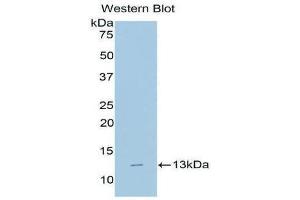 Western Blotting (WB) image for anti-beta-2-Microglobulin (B2M) (AA 22-119) antibody (FITC) (ABIN1172682) (beta-2 Microglobulin 抗体  (AA 22-119) (FITC))