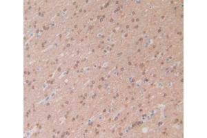 IHC-P analysis of Human Brain Tissue, with DAB staining. (CRYAB 抗体  (AA 1-175))