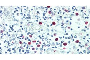 Immunohistochemistry of paraffin-embedded Thymus tissue using SRGN Polyclonal Antibody at dilution of 1:100. (SRGN 抗体)