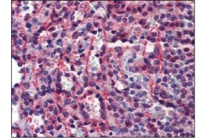 Immunohistochemistry (IHC) image for anti-Caspase 7, Apoptosis-Related Cysteine Peptidase (CASP7) antibody (ABIN614356) (Caspase 7 抗体)