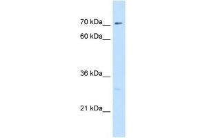 Ctp Synthase antibody used at 5 ug/ml to detect target protein. (CTP Synthase 抗体  (N-Term))