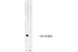 Image no. 1 for anti-Protein Phosphatase 1, Catalytic Subunit, alpha Isoform (PPP1CA) (AA 317-330), (C-Term), (Catalytic Subunit) antibody (ABIN264931) (PPP1CA 抗体  (C-Term, Catalytic Subunit))