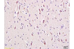Formalin-fixed and paraffin embedded rat brain tissue labeled with Anti-LRP5 + LRP6 Polyclonal Antibody, Unconjugated (ABIN681478) at 1:200 followed by conjugation to the secondary antibody and DAB staining (LRP5 抗体  (AA 451-550))
