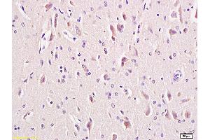 Formalin-fixed and paraffin embedded rat brain tissue labeled with Anti-LRP5 + LRP6 Polyclonal Antibody, Unconjugated (ABIN681478) at 1:200 followed by conjugation to the secondary antibody and DAB staining