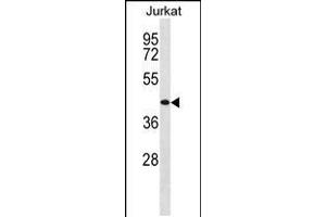 Western blot analysis in Jurkat cell line lysates (35ug/lane). (TRH 抗体  (AA 209-238))