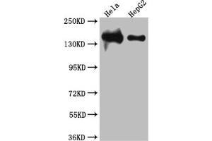 Western Blot Positive WB detected in: Hela whole cell lysate, HepG2 whole cell lysate All lanes: DNA Ligase I antibody at 1:1000 Secondary Goat polyclonal to rabbit IgG at 1/50000 dilution Predicted band size: 102, 89, 99 kDa Observed band size: 140 kDa (Recombinant LIG1 抗体)