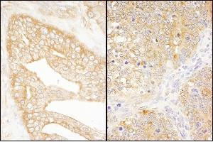 anti-Eukaryotic Translation Initiation Factor 3 Subunit J (EIF3S1) (AA 208-258) antibody
