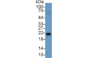 Western Blot; Sample: Human Serum; Primary Ab: 1µg/ml Rabbit Anti-Human RBP4 Antibody Second Ab: 0. (RBP4 抗体  (AA 18-201))