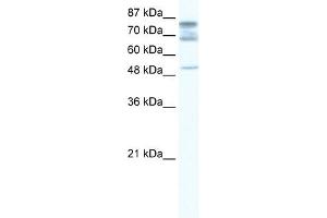 DDX46 antibody used at 1. (DDX46 抗体)