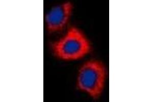 Immunofluorescent analysis of Recoverin staining in HeLa cells.
