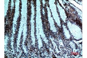 Immunohistochemistry (IHC) image for anti-Phospholipase A2, Group IVA (Cytosolic, Calcium-Dependent) (PLA2G4A) (N-Term) antibody (ABIN3187717)