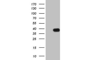 Western Blotting (WB) image for anti-Insulin-Like Growth Factor Binding Protein 1 (IGFBPI) (AA 26-259) antibody (ABIN2676854) (IGFBPI 抗体  (AA 26-259))