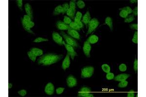 Immunofluorescence of monoclonal antibody to XAB1 on HeLa cell. (GPN1 抗体  (AA 9-118))