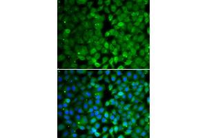 Immunofluorescence analysis of MCF-7 cells using RUNX3 antibody (ABIN6130682, ABIN6147314, ABIN6147315 and ABIN6223139). (RUNX3 抗体  (AA 210-429))