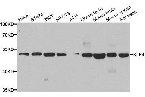 Western blot analysis of extracts of various cell lines, using KLF4 antibody. (KLF4 抗体  (AA 180-479))