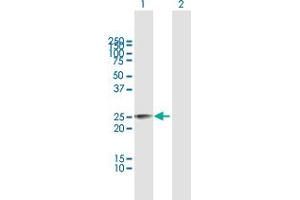 Western Blot analysis of MPZL3 expression in transfected 293T cell line by MPZL3 MaxPab polyclonal antibody.