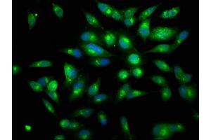 Immunofluorescence staining of Hela cells with ABIN7134517 at 1:150, counter-stained with DAPI. (Lactoferrin 抗体)