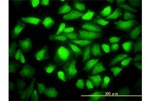 Immunofluorescence (IF) image for anti-DnaJ (Hsp40) Homolog, Subfamily B, Member 6 (DNAJB6) (AA 1-241) antibody (ABIN564339)
