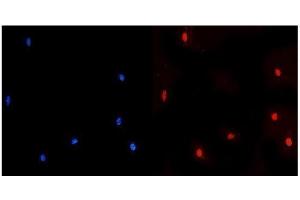 IF analysis of NUP214 using anti-NUP214 antibody (ABIN7601473). (NUP214 抗体  (AA 36-374))