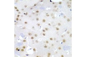 Immunohistochemistry of paraffin-embedded mouse brain using CDC27 antibody at dilution of 1:200 (40x lens). (CDC27 抗体)