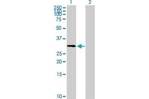 Western Blot analysis of ZNF511 expression in transfected 293T cell line by ZNF511 MaxPab polyclonal antibody. (ZNF511 抗体  (AA 1-252))