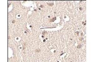 Immunohistochemistry of Slitrk2 in human brain tissue with this product at 2. (SLITRK2 抗体  (Middle Region))