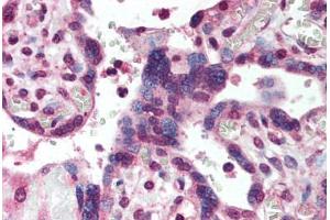 Human Placenta (formalin-fixed, paraffin-embedded) stained with SMAD2 antibody ABIN293877 at 5 ug/ml followed by biotinylated goat anti-rabbit IgG secondary antibody ABIN481713, alkaline phosphatase-streptavidin and chromogen. (SMAD2 抗体  (AA 234-249))