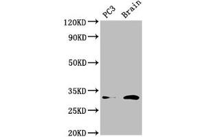 Western Blot Positive WB detected in: PC-3 whole cell lysate, Mouse brain tissue All lanes: HOXD8 antibody at 4. (HOXD8 抗体  (AA 59-108))