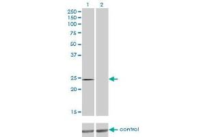Western blot analysis of QDPR over-expressed 293 cell line, cotransfected with QDPR Validated Chimera RNAi (Lane 2) or non-transfected control (Lane 1). (QDPR 抗体  (AA 1-244))