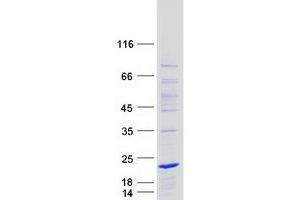 Validation with Western Blot