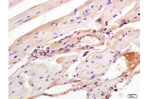 Formalin-fixed and paraffin embedded mouse heart labeled with Rabbit Anti Aggrecanase-2/ADAMTS5 Polyclonal Antibody, Unconjugated (ABIN701005) at 1:200 followed by conjugation to the secondary antibody and DAB staining (ADAMTS5 抗体  (AA 511-610))