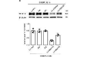 LV-TMEM16F-RNAi transfection downregulates TMEM16F in rat brain.