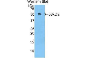 Western blot analysis of the recombinant protein. (ANGPTL3 抗体  (AA 237-455))