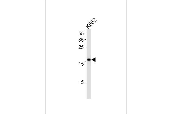 POLE3 抗体  (N-Term)