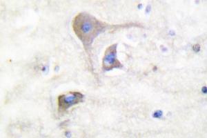 Image no. 2 for anti-Synuclein, beta (SNCB) antibody (ABIN271836) (beta Synuclein 抗体)