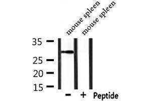 Western blot analysis of extracts from mouse spleen, using POMC Antibody. (POMC 抗体  (C-Term))