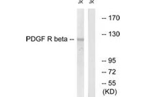 Western blot analysis of extracts from Jurkat cells, treated with TNF-a 20ng/ml 5', using PDGFR beta (Ab-740) Antibody. (PDGFRB 抗体  (AA 711-760))