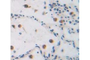 IHC-P analysis of Human Tissue, with DAB staining. (GADD45A 抗体  (AA 1-165))