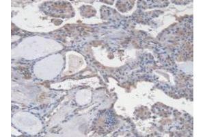Immunohistochemistry (IHC) image for anti-Vascular Endothelial Cell Growth Factor 121 (VEGF121) (AA 28-147) antibody (ABIN7428347)
