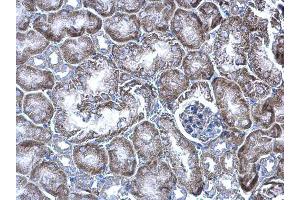 Immunohistochemistry (IHC) image for anti-Williams Beuren Syndrome Chromosome Region 22 (WBSCR22) (Center) antibody (ABIN2856201)