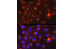 Immunofluorescence (IF) image for anti-AXL Receptor tyrosine Kinase (AXL) antibody (ABIN7265804)