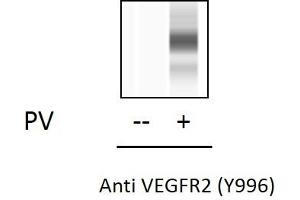 HUVEC cells were untreated or treated with PV. (VEGFR2/CD309 ELISA 试剂盒)