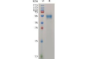 Human PRNP(90-230) Protein, hFc Tag on SDS-PAGE under reducing condition.